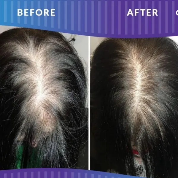 Hair work by Alternative Beauty Wellness Hair Salon & Scalp Clinic